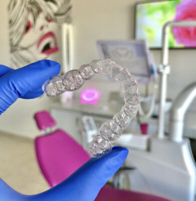 aligneurs invisalign
